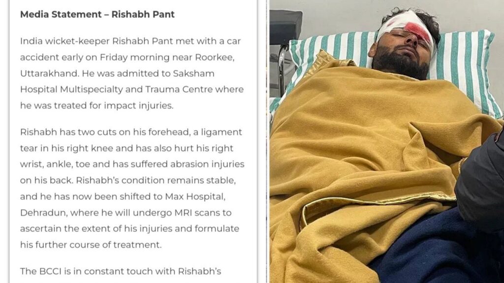 அடக்கடவுளே இத்தனை இடத்தில் காயமா.. ரிஷப் பண்ட் மருத்துவ அறிக்கையை வெளியிட்டது பிசிசிஐ!